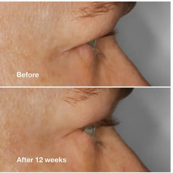 CLINIQUE High Impact Lash Amplifying Serum, NEW - Picture 3 of 7